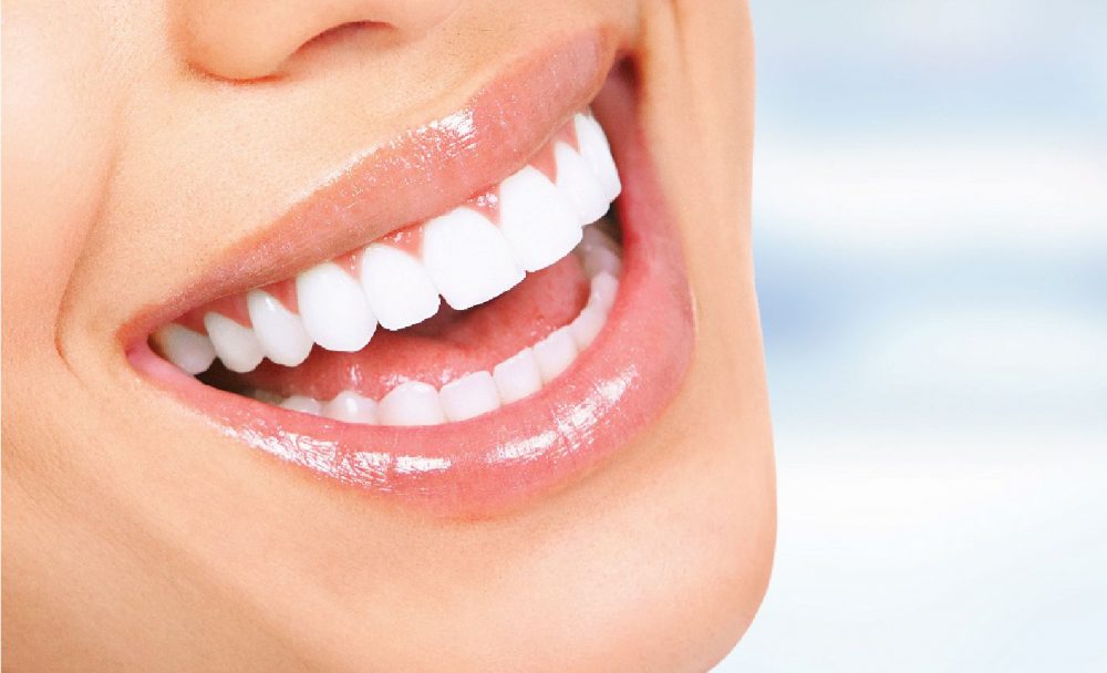 Clareamento Dental: Descubra as Principais Opções para um Sorriso Brilhante